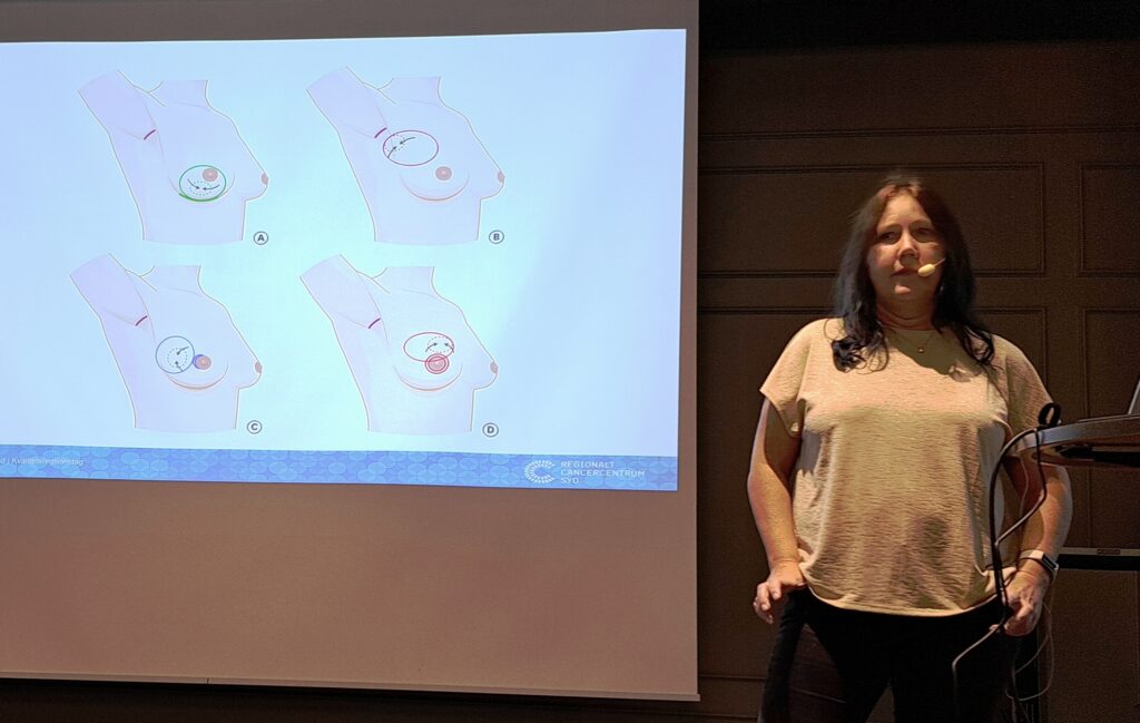 Maria Erngrund föreläser på registerag i Hässleholm 2023. På hennes rpesentation visas bilder på olika typer av bröstoperationer.