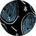 Röntgenbild på två hjärnor.